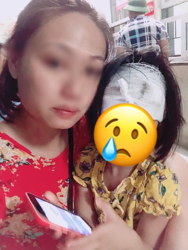 Chồng cầm chảo đánh vợ lúc cãi nhau, con gái hơn 3 tuổi bị vạ lây phải khâu 5 mũi khiến dân mạng xót xa-2