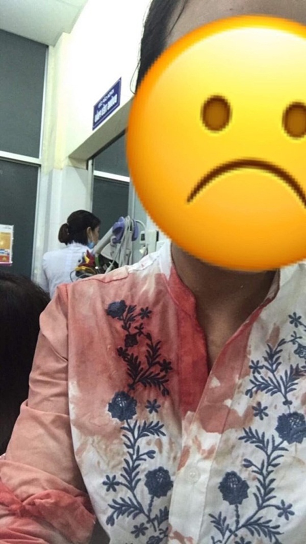 Chồng cầm chảo đánh vợ lúc cãi nhau, con gái hơn 3 tuổi bị vạ lây phải khâu 5 mũi khiến dân mạng xót xa-4