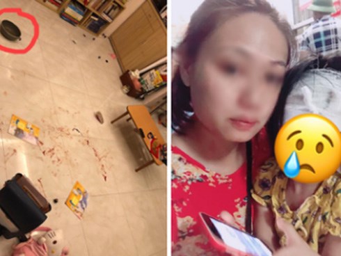 Chồng cầm chảo đánh vợ lúc cãi nhau, con gái hơn 3 tuổi bị vạ lây phải khâu 5 mũi khiến dân mạng xót xa