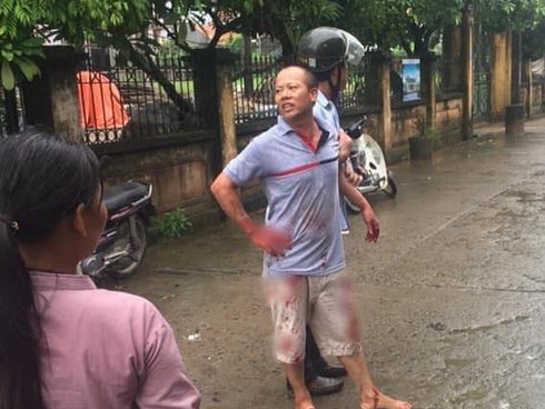 Đối tượng truy sát cả gia đình em trai bình thản khi bị bắt: 