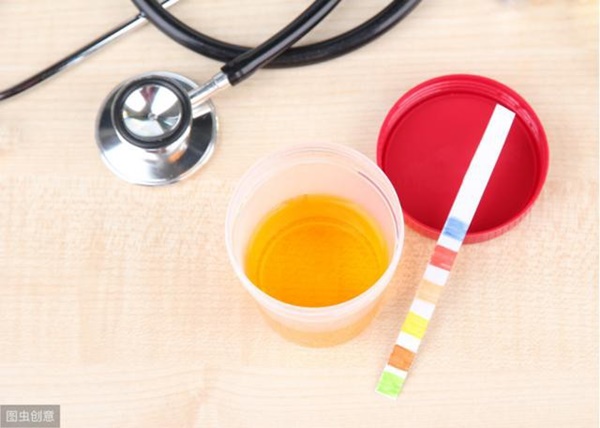 Người đàn ông 36 tuổi nhập viện vì suy thận, thủ phạm chính là 2 loại nước nhiều người thích-1