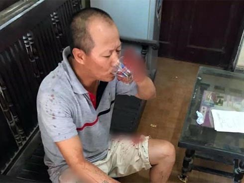 Thảm án 5 người thương vong ở Hà Nội: Nghi phạm Đông có thể phải đối diện hình phạt nào?