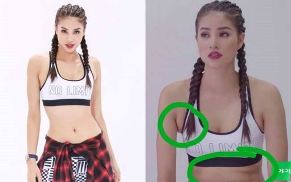 Hài hước chuyện dao kéo trong tích tắc: Minh Hằng sửa đến mất cả nách-16