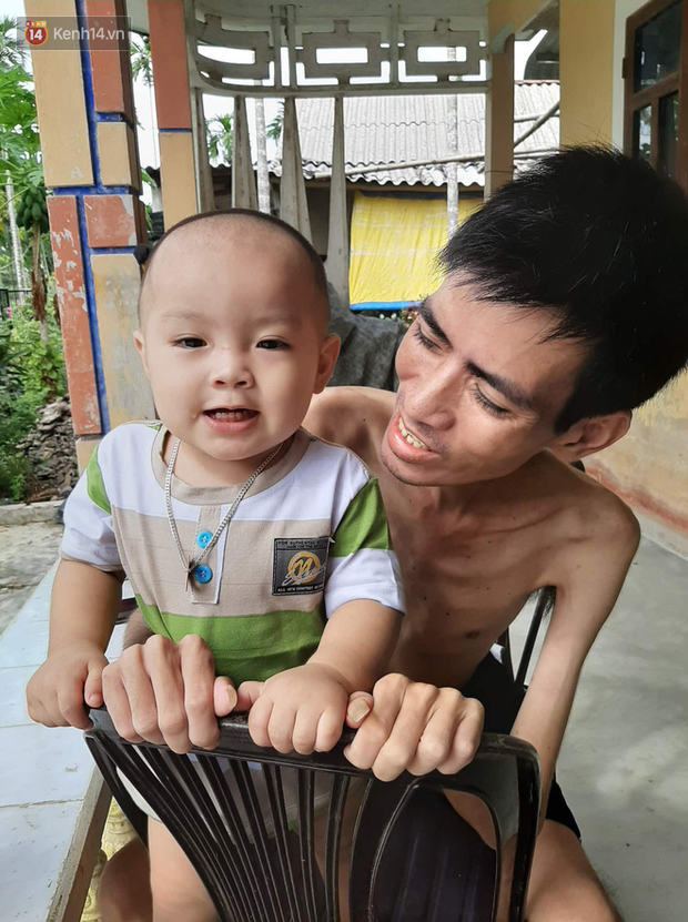 Xót xa chàng trai gầy trơ xương vì mắc bệnh hiểm nghèo chỉ 2 tháng sau đám cưới: Em phải sống, để hiến thận cứu con mình-9