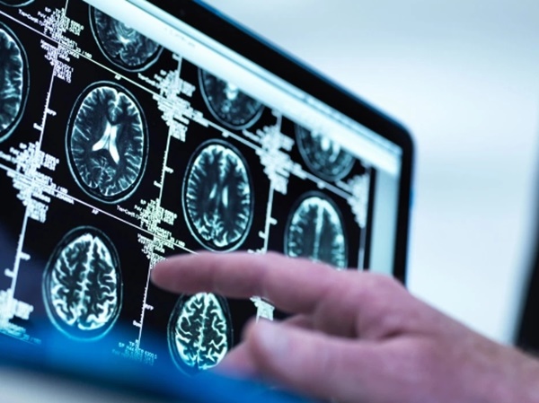 10 dấu hiệu ung thư sớm nhiều người thường chủ quan-1