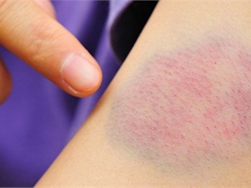 10 thay đổi trên cơ thể tưởng nhẹ nhưng báo động bệnh nguy hiểm, 3 điều cảnh báo ung thư-11