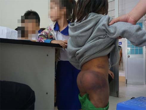 Vụ 4 học sinh nghi bị người thân bạo hành: Cha mẹ các bé đến nhận lại con