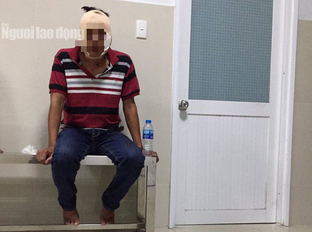 Đại úy công an bị đánh trọng thương do đối tượng vi phạm giao thông ôm hận”-2