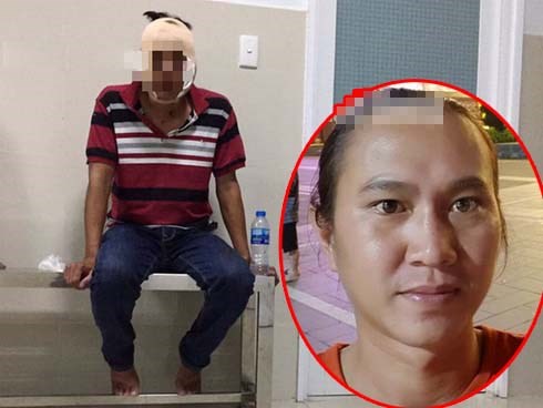 Đại úy công an bị đánh trọng thương do đối tượng vi phạm giao thông “ôm hận”