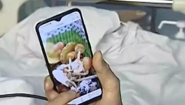 Hai mẹ con bị suy gan chỉ vì loại thực phẩm tưởng lành nhưng hóa ra rất độc-2