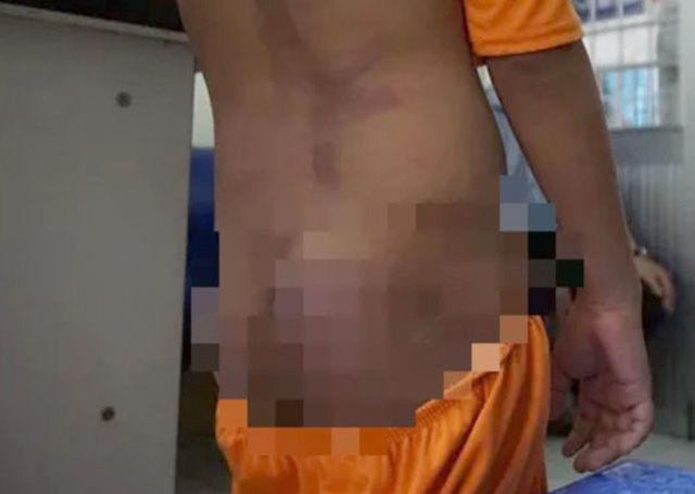 4 trẻ nhỏ ở Cà Mau nghi bị ông nội và chị bạo hành: Thu nhiều vật chứng ở hiện trường-1