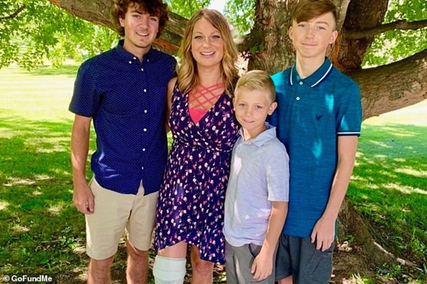 Người phụ nữ này bị sốc nhiễm độc kéo dài nhiều năm đến nỗi phải cắt ngón tay, ngón chân, nguyên nhân chỉ từ một cú ngã-2