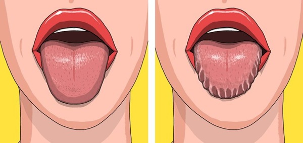 10 thay đổi trên cơ thể tưởng nhẹ nhưng báo động bệnh nguy hiểm, 3 điều cảnh báo ung thư-1