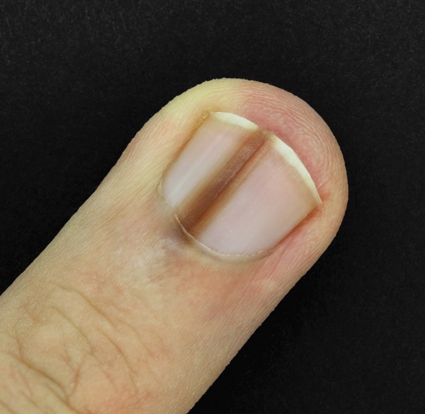 10 thay đổi trên cơ thể tưởng nhẹ nhưng báo động bệnh nguy hiểm, 3 điều cảnh báo ung thư-2