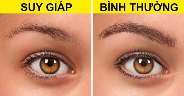 10 thay đổi trên cơ thể tưởng nhẹ nhưng báo động bệnh nguy hiểm, 3 điều cảnh báo ung thư-5