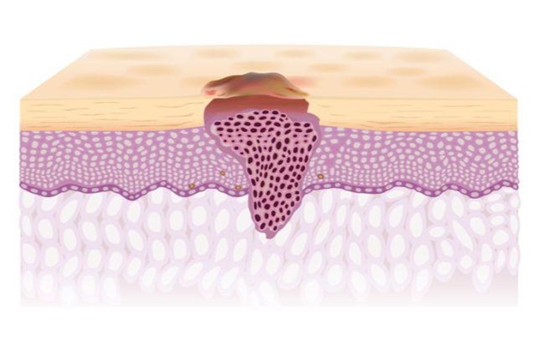 10 thay đổi trên cơ thể tưởng nhẹ nhưng báo động bệnh nguy hiểm, 3 điều cảnh báo ung thư-6