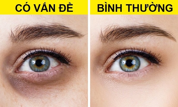 10 thay đổi trên cơ thể tưởng nhẹ nhưng báo động bệnh nguy hiểm, 3 điều cảnh báo ung thư-10