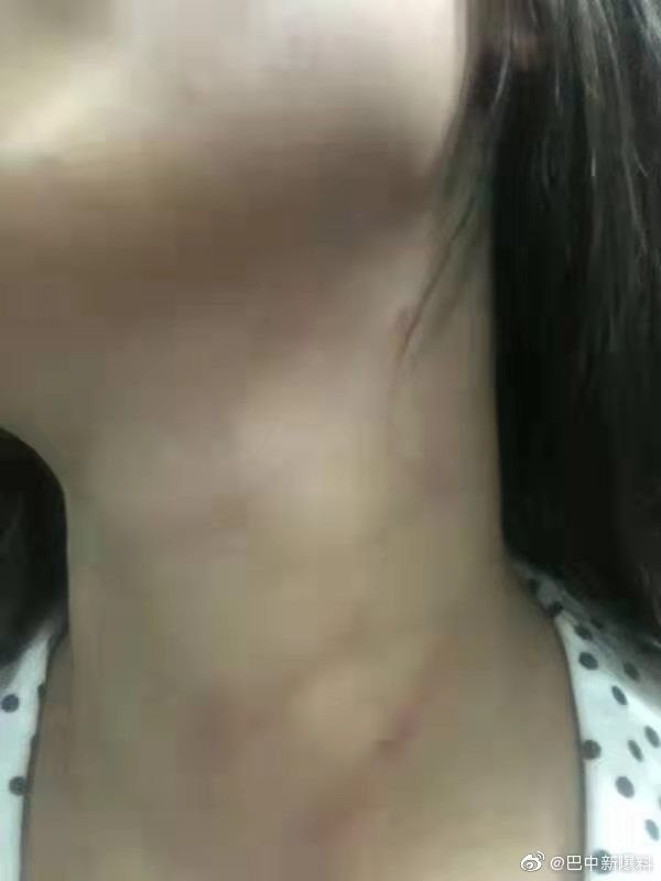 Bị chồng bạo hành, cô giáo xinh đẹp nhảy lầu tự vẫn, chồng có mặt ở hiện trường nhưng khai nhận không thấy vợ làm chuyện dại dột-3