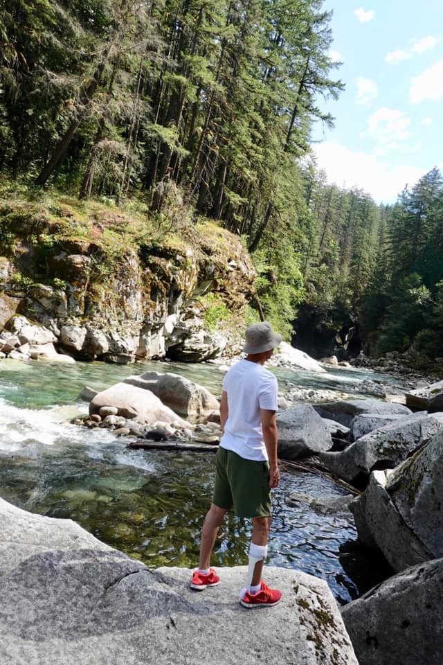 Bạn gái của Việt kiều Canada bị tạt axit ám ảnh: Không một ngày nào chúng tôi quên được những gì đã xảy ra trong đêm đó-3