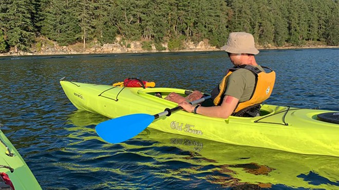 Bạn gái của Việt kiều Canada bị tạt axit ám ảnh: Không một ngày nào chúng tôi quên được những gì đã xảy ra trong đêm đó-4