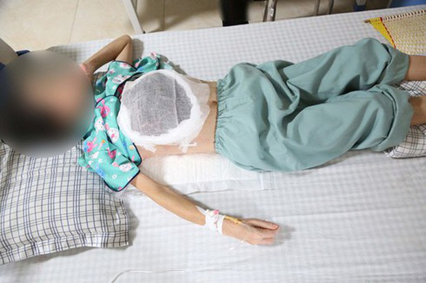 Người phụ nữ ngực bị lở loét, hoại tử do thầy lang bảo cứ chờ khối u vỡ-1