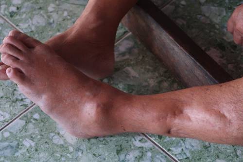 Tuổi xế chiều của gia đình 4 người tàn tật và nỗi đau: Muốn chết lắm nhưng không được”-1