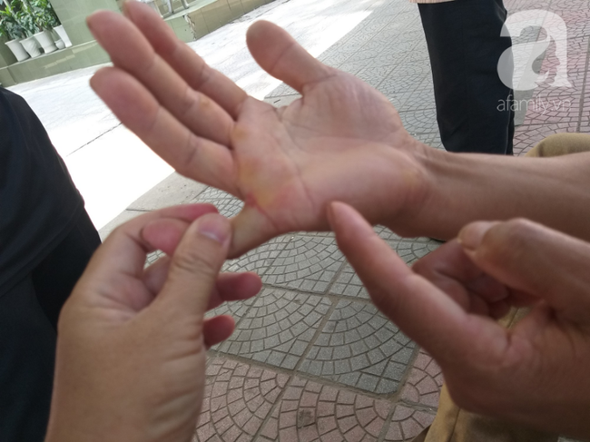 Bố của bé trai 10 tuổi bị người thân chém đứt lìa bàn tay ở Bắc Giang: Giờ tôi chưa dám lại nhìn con-3