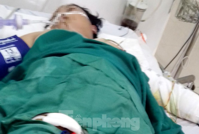 Chồng tưới xăng đốt vợ đang mang thai 8 tháng-1