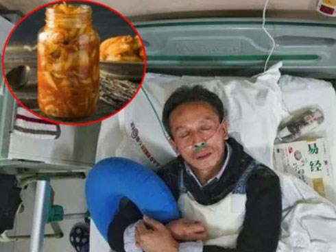 3 anh em ruột cùng mắc ung thư dạ dày: Vừa nhìn mâm cơm bác sĩ đã khẳng định nguyên nhân