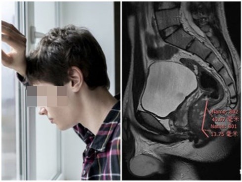 17 tuổi mắc ung thư trực tràng, bác sĩ nói thực hiện 4 thói quen này trước khi muộn
