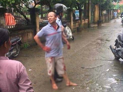 Bố nạn nhân sống sót trong vụ thảm sát ở Đan Phượng: Nhung chưa biết con gái đã tử vong”-3