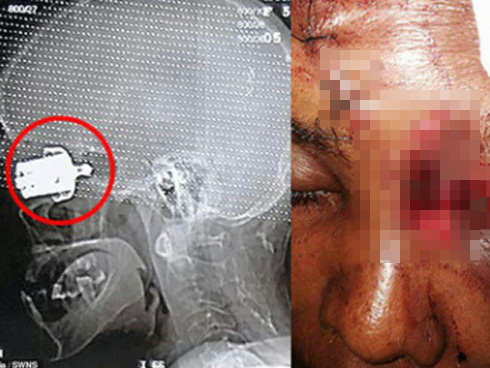 3 sai lầm khi sử dụng khiến nồi áp suất nổ như bom, lấy mạng cả nhà-4