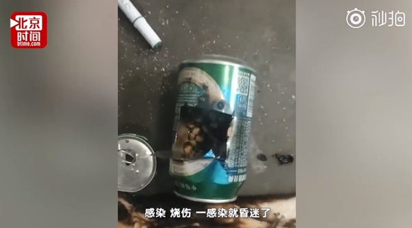 Bắt chước thánh nữ văn phòng Tiểu Dã làm bỏng ngô tại nhà, bé gái 14 tuổi gặp tai nạn bỏng nặng rồi tử vong sau hơn 1 tuần-3