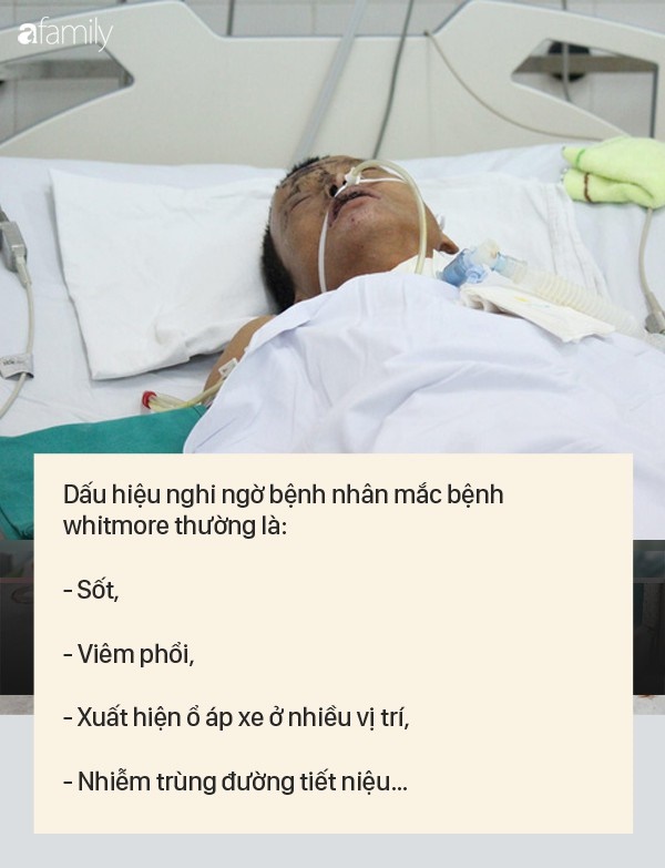 Dấu hiệu bệnh whitmore - căn bệnh do vi khuẩn ăn mòn cơ thể con người, có thể gây tử vong trong vài ngày-2