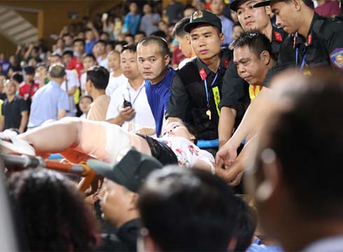 Hà Nội -Nam Định: Nữ CĐV đi cấp cứu vì trúng pháo sáng, Hàng Đẫy thất thủ-1