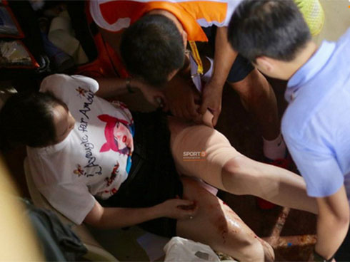 Fan nữ bị bỏng vì pháo sáng phải phẫu thuật 2 lần-5