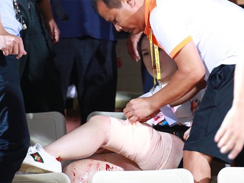 Khán giả nữ bị bỏng pháo sáng được chi trả toàn bộ viện phí-2