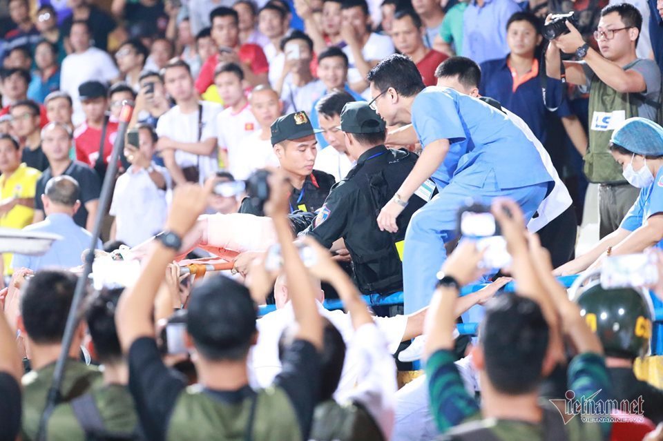 Fan nữ bị bỏng vì pháo sáng phải phẫu thuật 2 lần-2