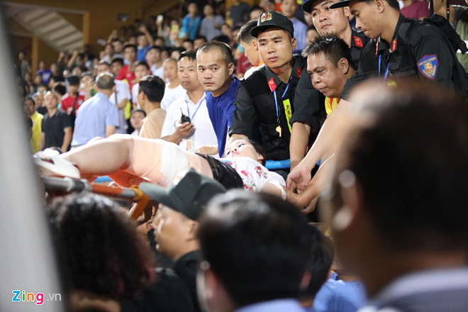 Khán giả nữ bị bỏng pháo sáng được chi trả toàn bộ viện phí-1