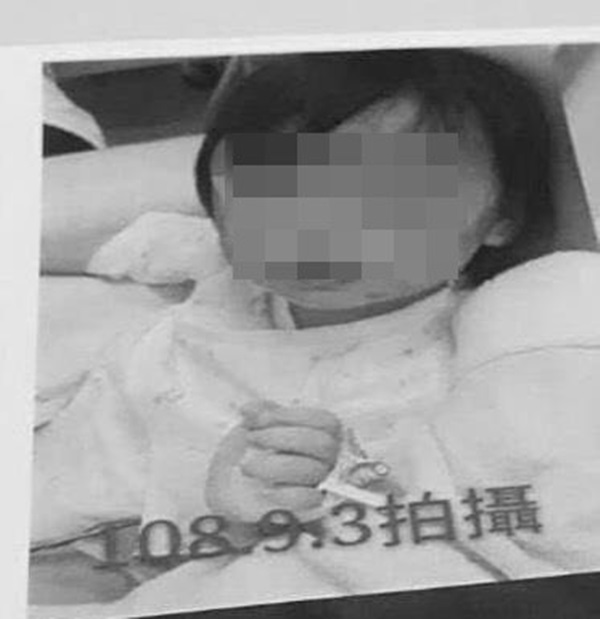 Sống với mẹ nhưng tối nào cũng phải sang cho bố chăm sóc, bé gái hơn 1 tuổi bất ngờ nhập viện trong tình trạng toàn thân tổn thương nghiêm trọng-2