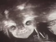 Đi siêu âm thai nhi 24 tuần tuổi, bà mẹ hết hồn khi thấy hình ảnh bé con như đang nhìn chằm chằm mình