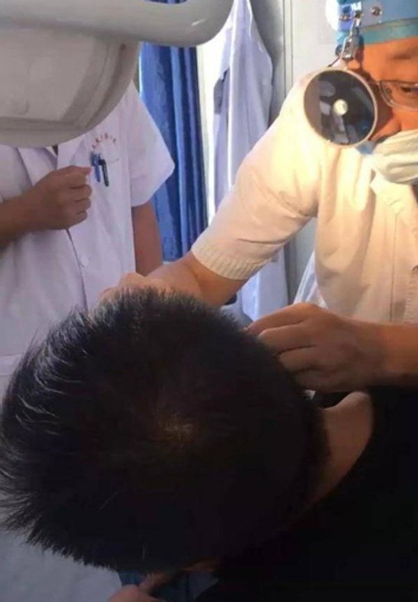 Nhét tỏi vào lỗ tai để trị đau tai gây mất ngủ, người đàn ông phải nhận kết đắng-2