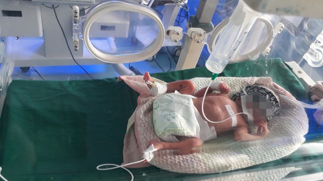 Chồng đốt vợ vì ghen, cả 2 tử vong, 3 con nhỏ bơ vơ-1