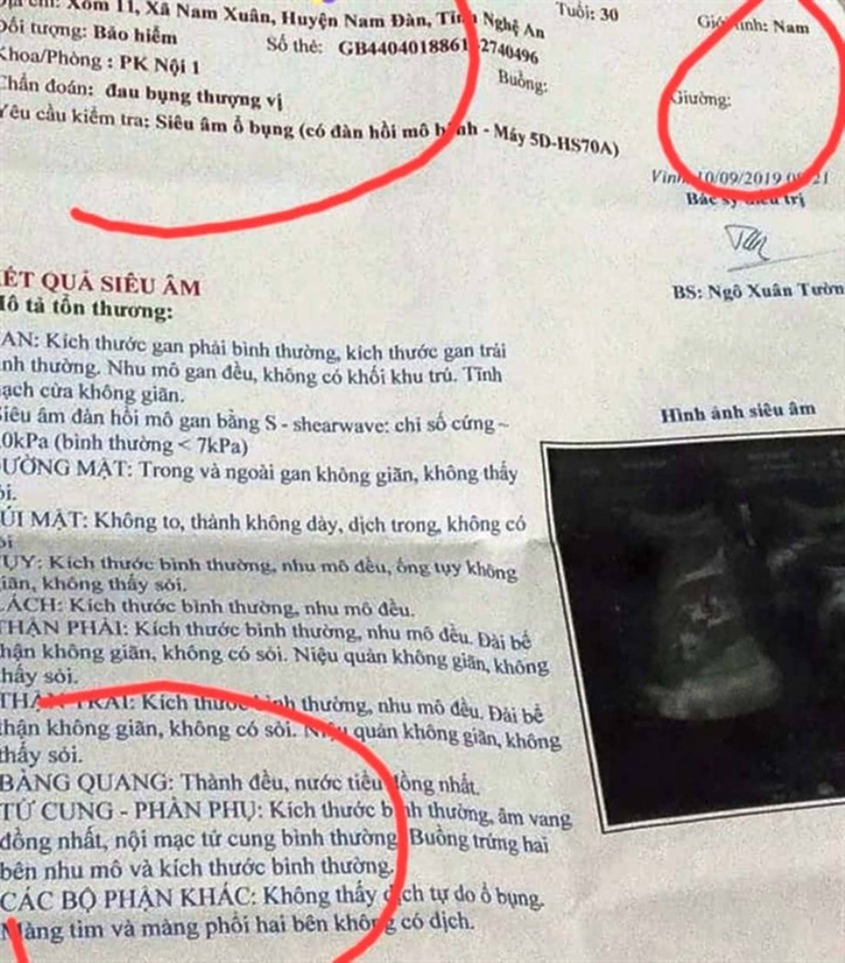 Người đàn ông ở Nghệ An sốc khi kết quả siêu âm có tử cung, buồng trứng-1