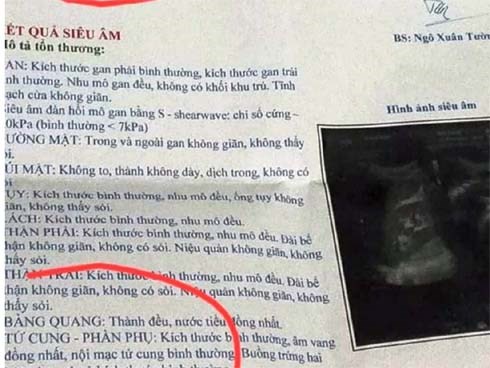 Người đàn ông ở Nghệ An sốc khi kết quả siêu âm có tử cung, buồng trứng