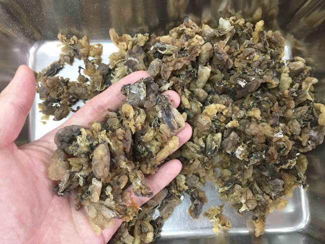 Mỏ vàng trong bụng ếch không ai đoái hoài, giá 1,5 triệu chưa đến 1 lạng-2