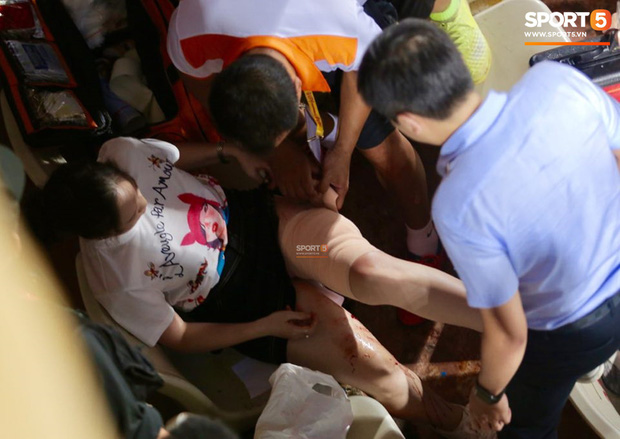 Vụ cổ động viên nữ trọng thương do trúng pháo sáng: Công an triệu tập 14 người quê ở Nam Định để điều tra-1