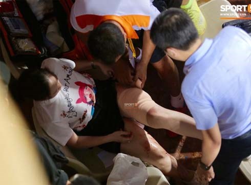 Vụ cổ động viên nữ trọng thương do trúng pháo sáng: Công an triệu tập 14 người quê ở Nam Định để điều tra