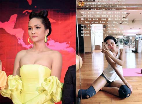 Hút mỡ làm đẹp: Tham một lần chơi lớn combo, gánh không nổi hậu họa-2