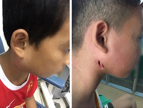 Phòng bệnh whitmore ăn thịt người: Người dân cần làm tốt những việc này-6